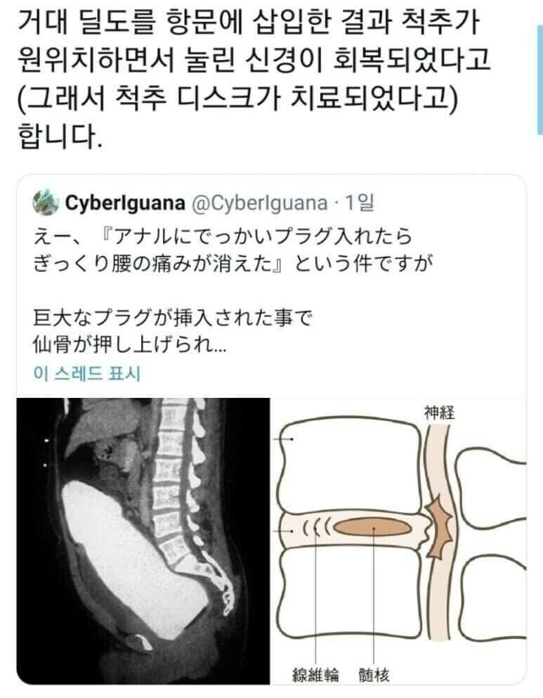 bt0847301737cd8576a895a02b8131332f.jpeg